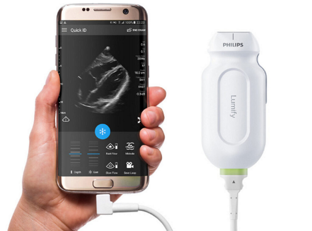 Philips Lumify ultrassom portátil